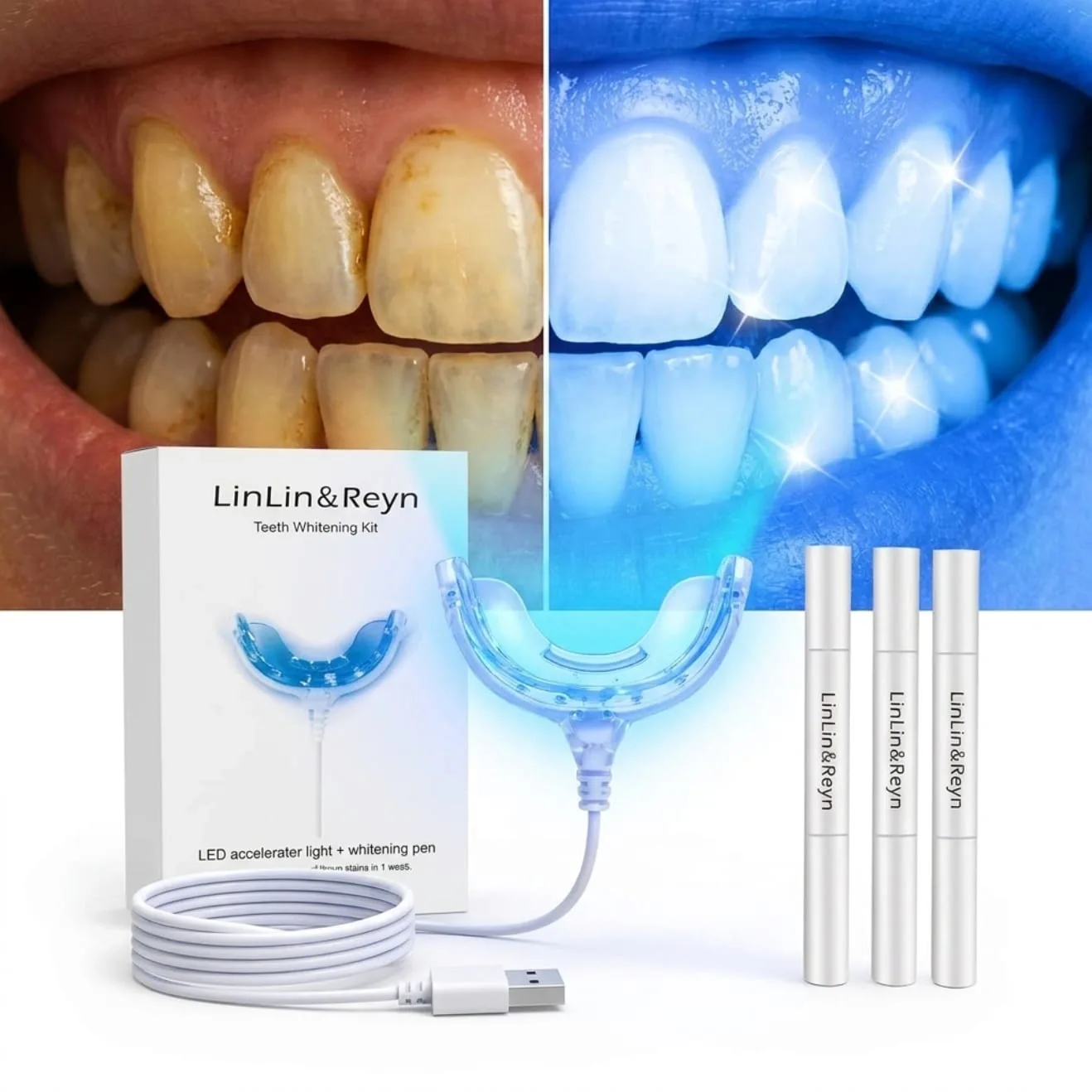 طقم Dana Smile لتبييض الأسنان بقالب LED وثلاثة أقلام جل